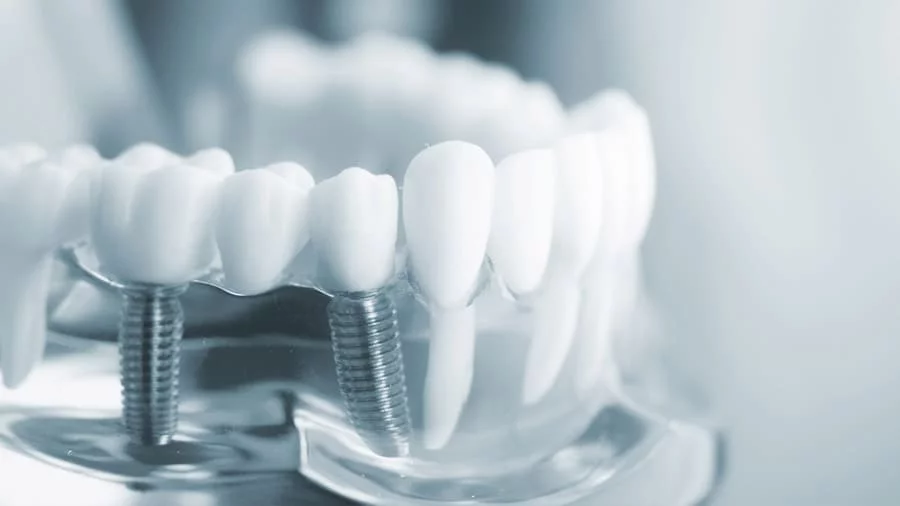 Image hover effect image