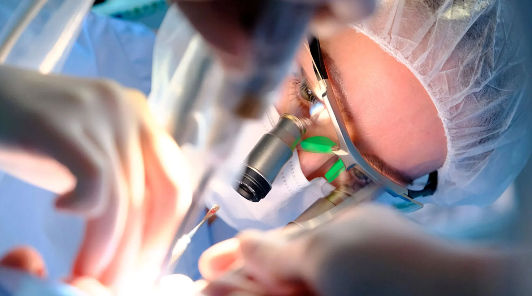 Image hover effect image