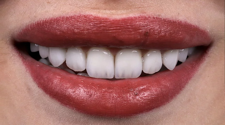 Image hover effect image