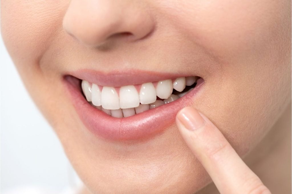 Smile Makeover