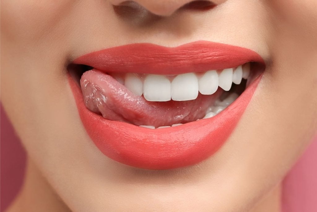 Smile Makeover