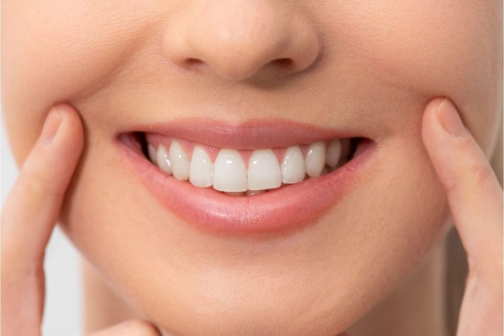 Smile Makeover nedir