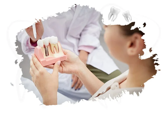 implant