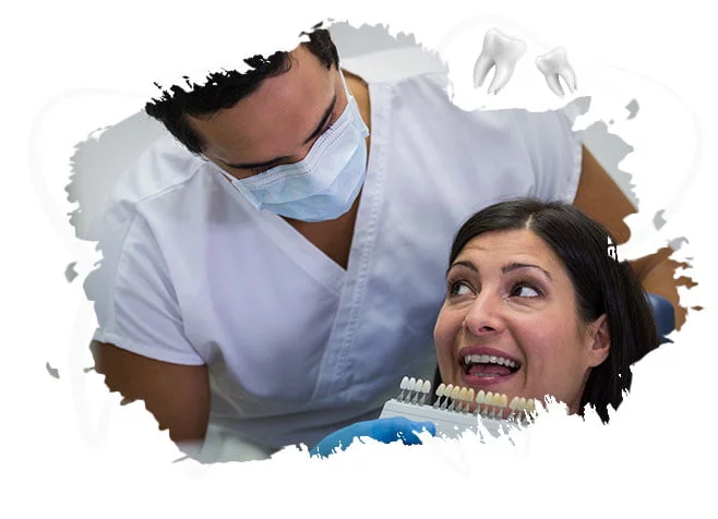laminate-veneers