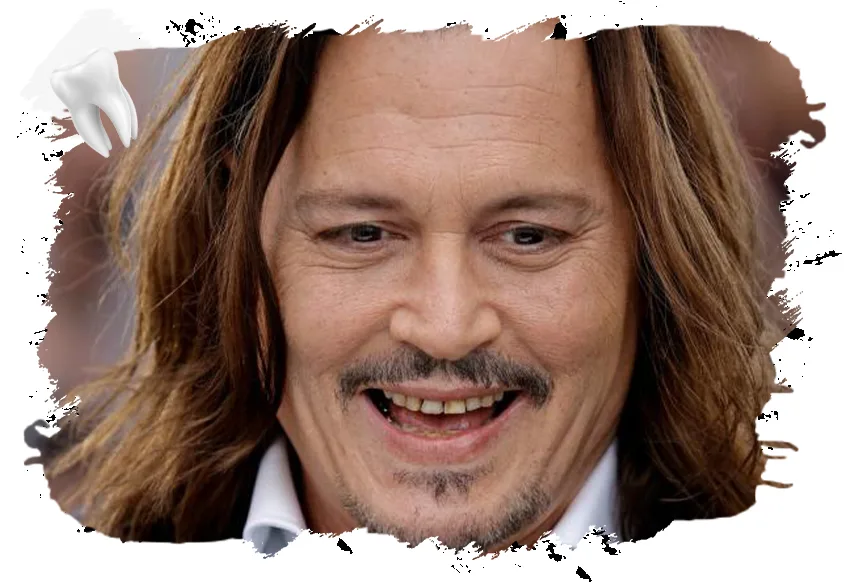 Wie waren die Zähne des jungen Johnny Depp? Hatte er irgendwelche Eingriffe? 2 Johnny Deep