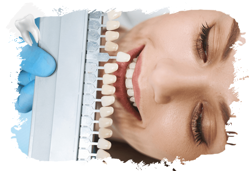 Die Bedeutung der Farbwahl bei Porzellanveneers 1 Porselen Kaplamada Renk Seçiminin Önemi