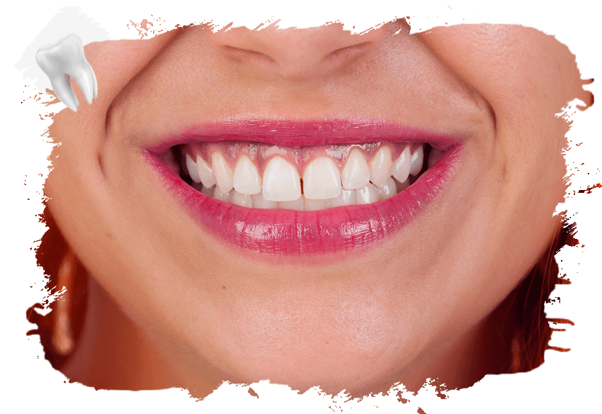 Diş Eti Rengi Neden Koyulaşır ve Nasıl Açılır