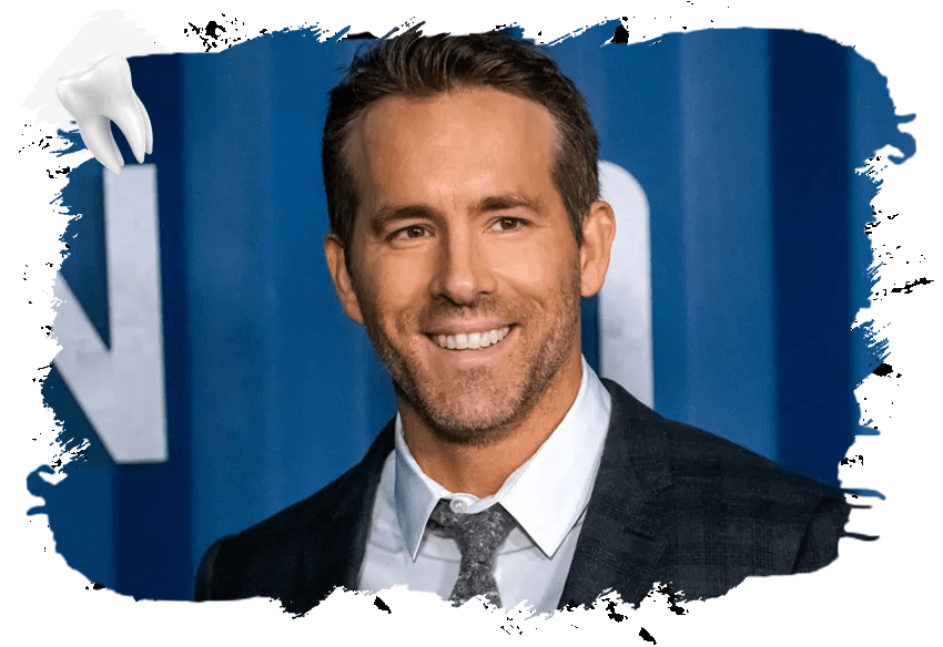 Young Ryan Reynolds Teeth